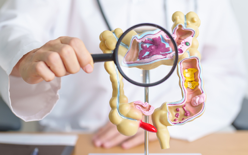 過敏性腸症候群とは